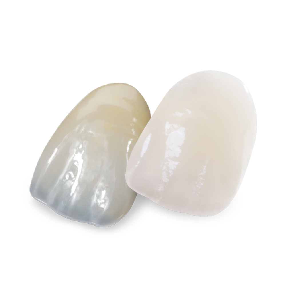 BruxZir Esthetic + e.max